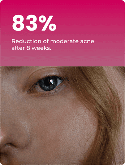 %83